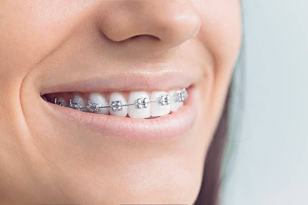 Advanced Technology for Better Dental Care in Aspen Hill, MD